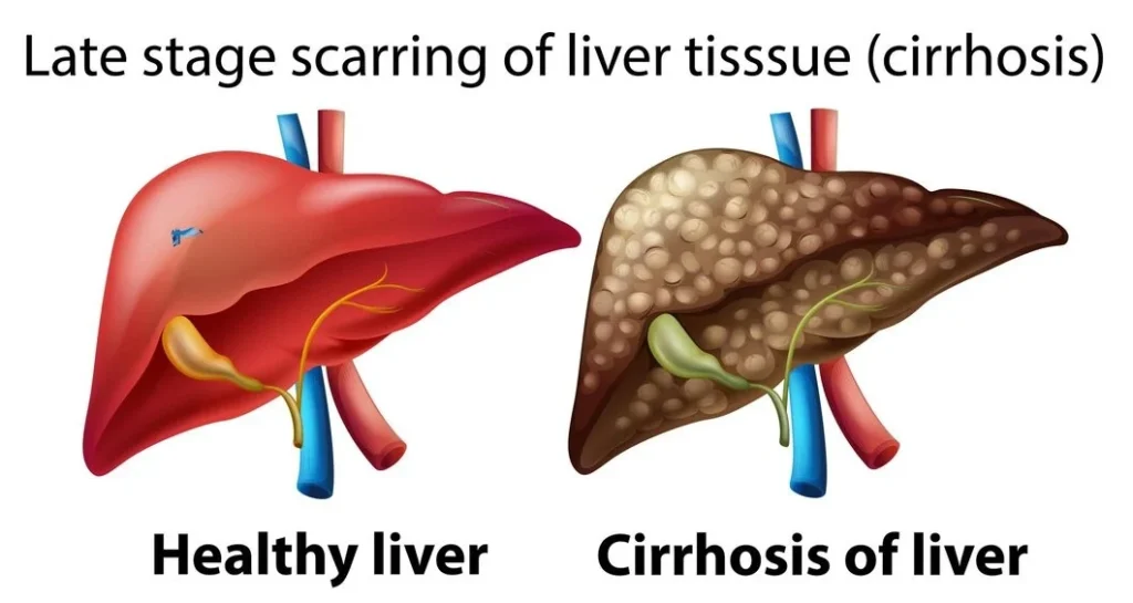 Gastric & Constipation 4